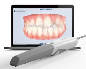 3D model of teeth