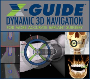 X-guide navigation