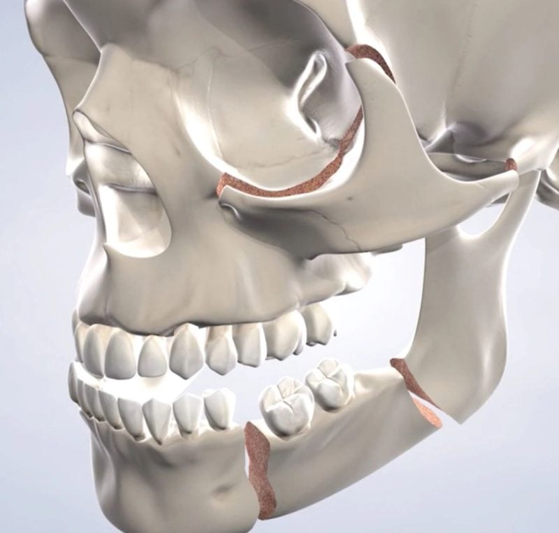 Skeletal Jaw